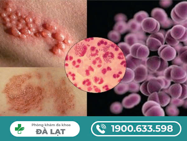 Hình ảnh minh họa